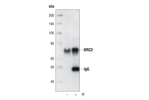 Immunoprecipitation Image 1: ORC2 (3G6) Rat mAb
