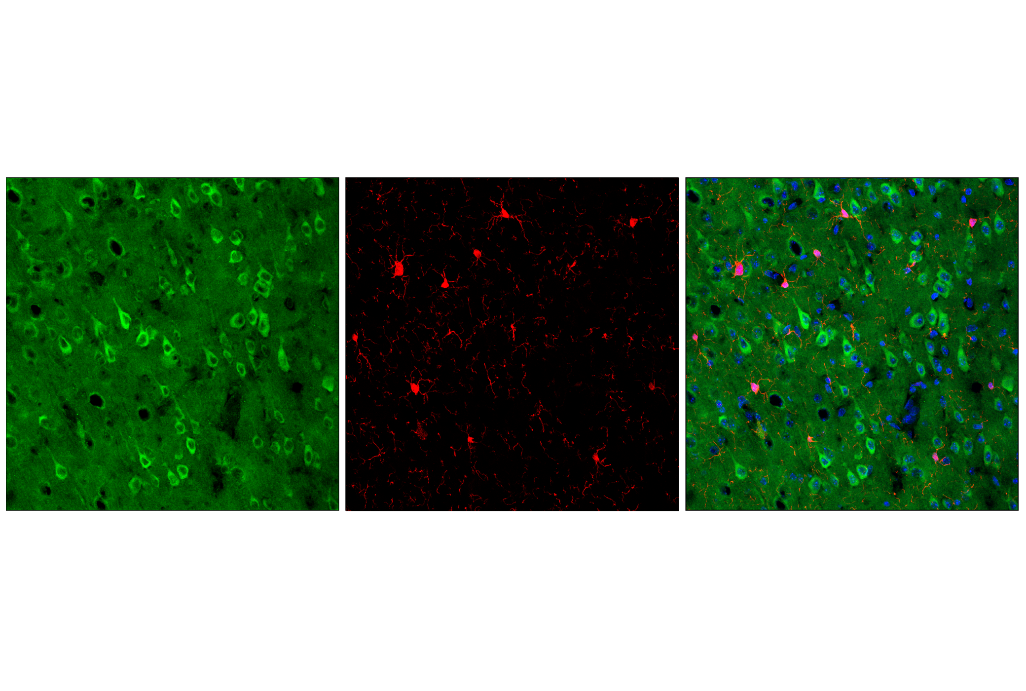 Immunofluorescence Image 1: Rab7 (E9O7E) Mouse mAb (Alexa Fluor® 488 Conjugate)