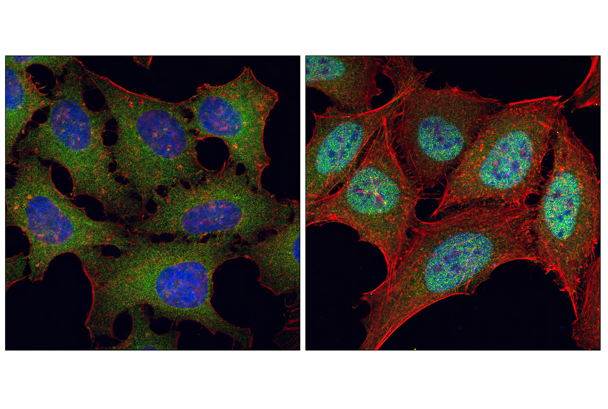 Immunofluorescence Image 1: NF-κB p65 (C22B4) Rabbit mAb