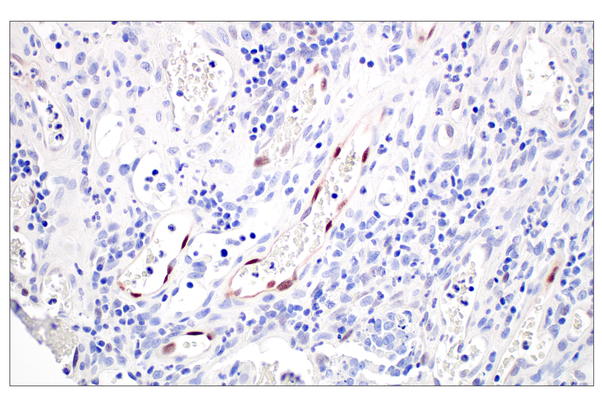 Immunohistochemistry Image 4: ARK5 (E4T2A) Rabbit mAb