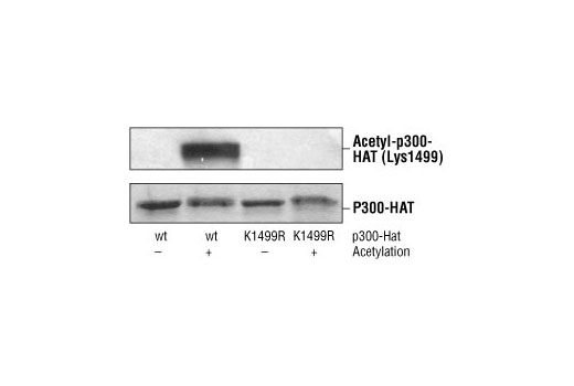  Image 12: Lysine Acetyltransferase Antibody Sampler Kit