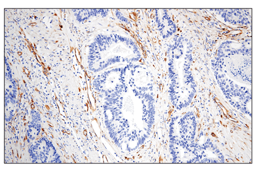 Immunohistochemistry Image 1: IGFBP7 (E3Z8L) XP® Rabbit mAb