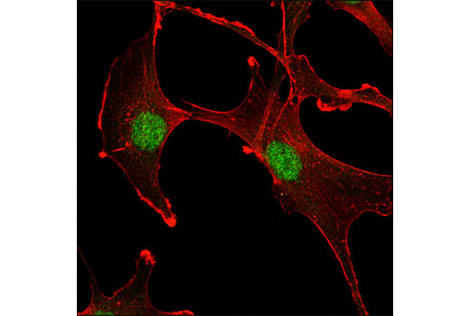 Immunofluorescence Image 1: Ubc9 (D26F2) XP® Rabbit mAb