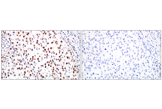 Immunohistochemistry Image 8: MLH1 (ES05) Mouse mAb