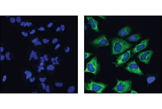 Immunofluorescence Image 1: Phospho-S6 Ribosomal Protein (Ser235/236) (D57.2.2E) XP® Rabbit mAb (Alexa Fluor® 488 Conjugate)