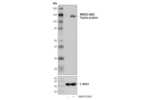 Western Blotting Image 1: MAGI3-Akt3 Fusion Protein (D4D3P) Rabbit mAb