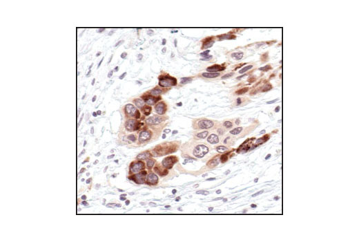 Immunohistochemistry Image 2: IκBα (L35A5) Mouse mAb (Amino-terminal Antigen) (BSA and Azide Free)