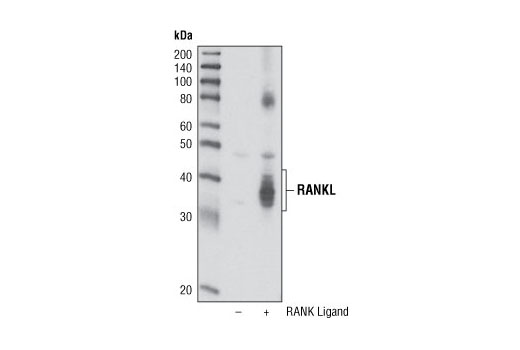 Western Blotting Image 1: RANK Ligand (L300) Antibody