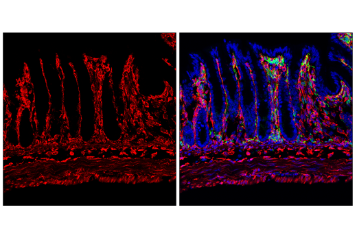 Immunofluorescence Image 3: HSP47/SERPINH1 (E4L3I) Rabbit mAb