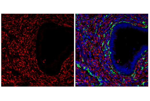 Immunofluorescence Image 1: HSP47/SERPINH1 (E4L3I) Rabbit mAb