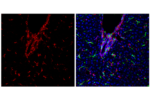 Immunofluorescence Image 2: HSP47/SERPINH1 (E4L3I) Rabbit mAb