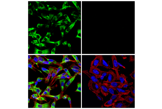 Immunofluorescence Image 4: HSP47/SERPINH1 (E4L3I) Rabbit mAb