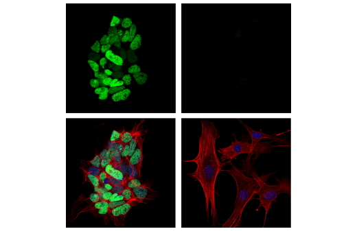 Immunofluorescence Image 1: DNMT3B (E4I4O) Rabbit mAb