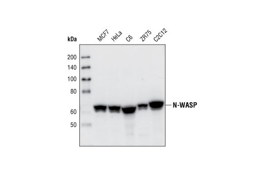 Western Blotting Image 1: N-WASP (30D10) Rabbit mAb