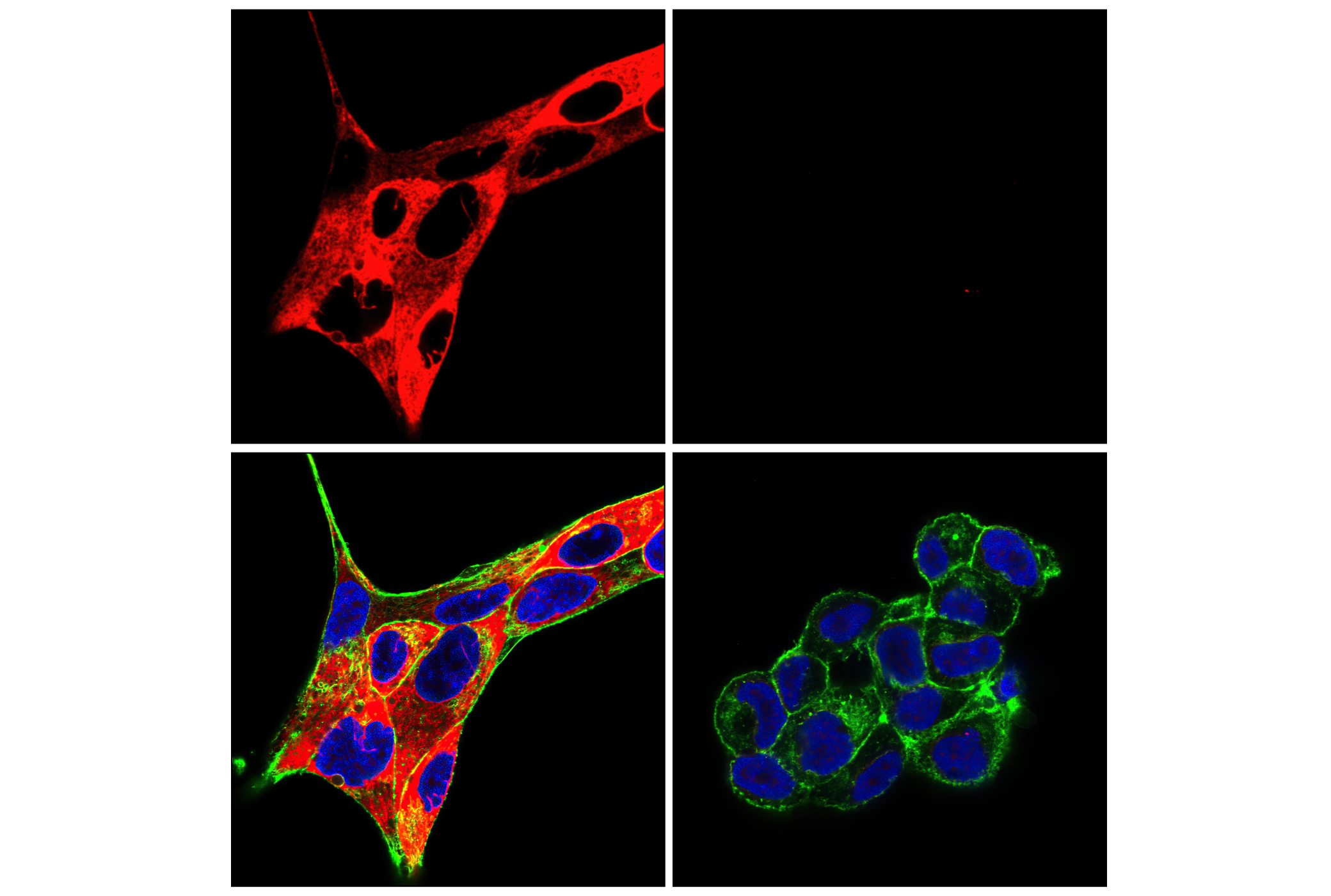 Immunofluorescence Image 1: Phospho-S6 Ribosomal Protein (Ser235/236) (D57.2.2E) XP® Rabbit mAb (Alexa Fluor® 647 Conjugate)