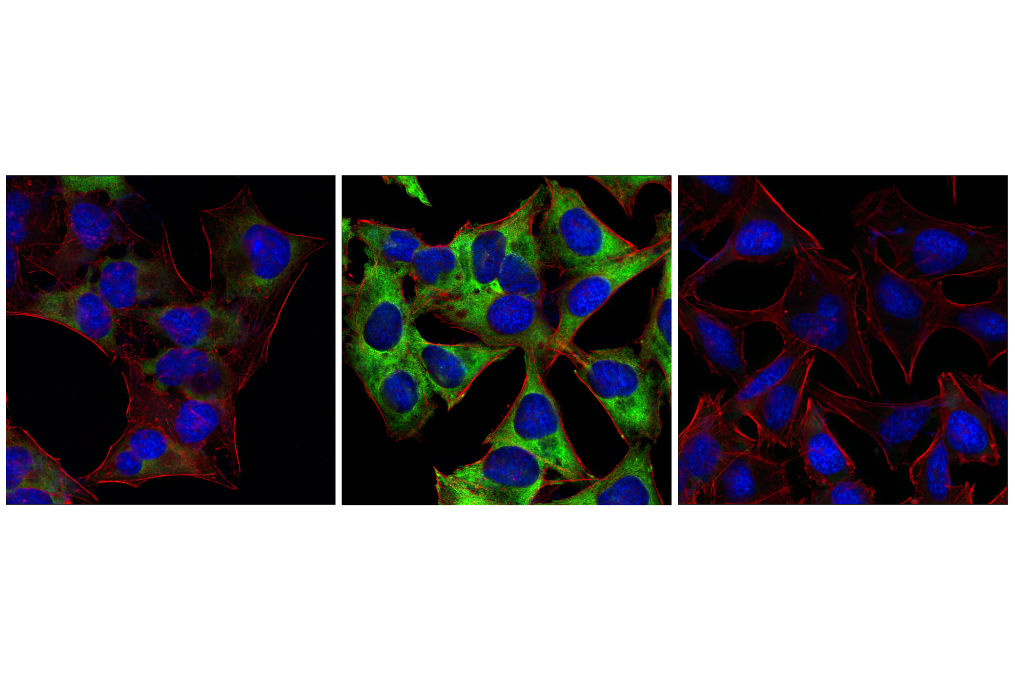 Immunofluorescence Image 1: Phospho-S6 Ribosomal Protein (Ser235/236) (2F9) Rabbit mAb