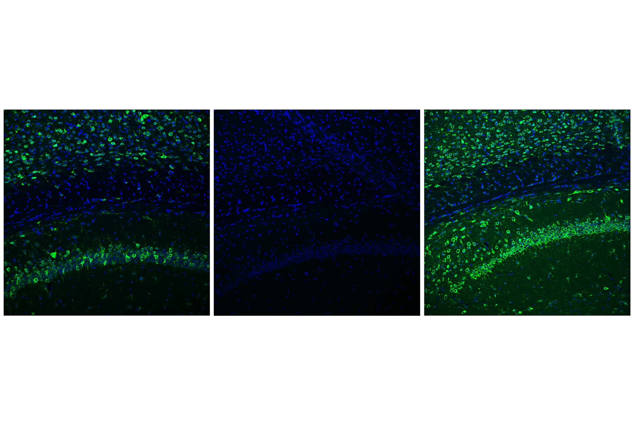 Immunofluorescence Image 1: Phospho-S6 Ribosomal Protein (Ser235/236) (D57.2.2E) XP® Rabbit mAb