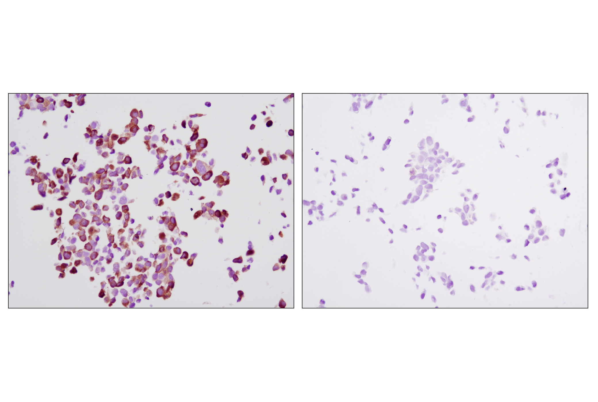  Image 15: p70 S6 Kinase Substrates Antibody Sampler Kit