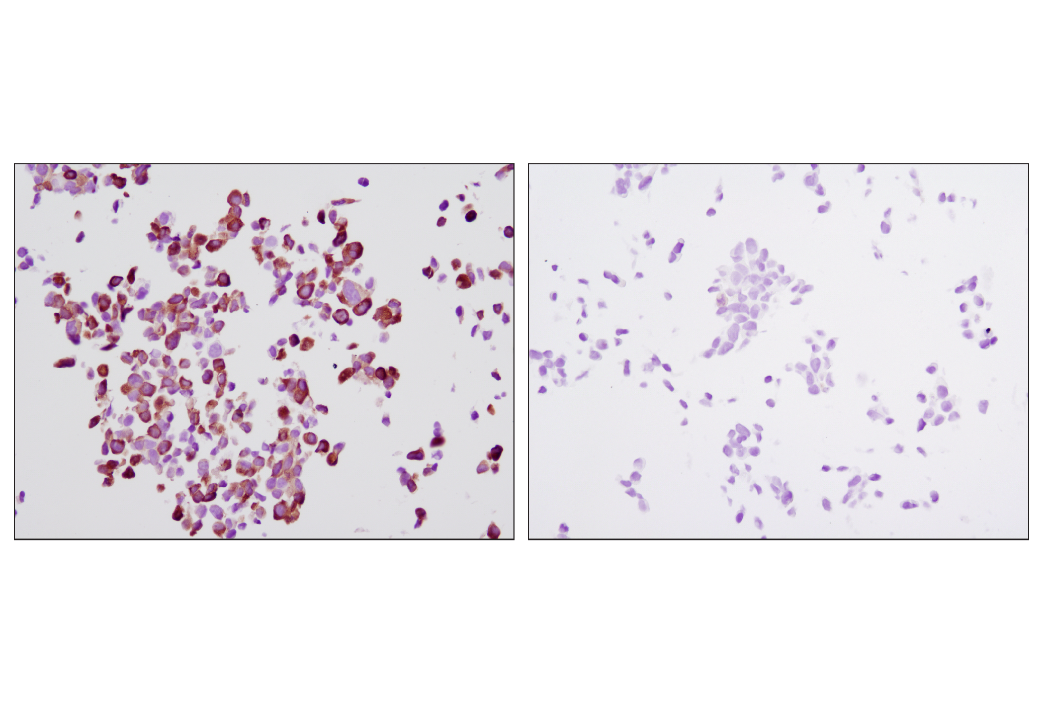  Image 28: p70 S6 Kinase Substrates Antibody Sampler Kit