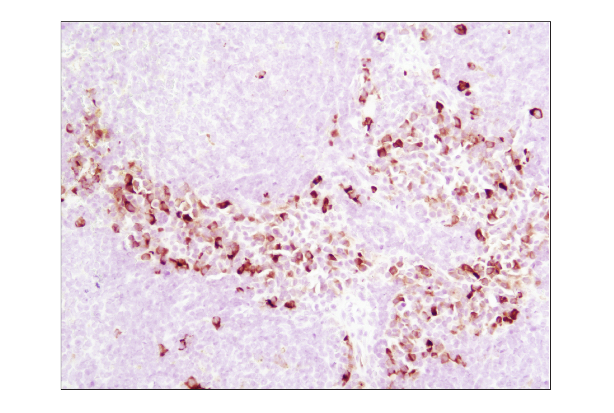 Immunohistochemistry Image 4: Phospho-S6 Ribosomal Protein (Ser235/236) (D57.2.2E) XP® Rabbit mAb