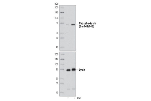 Western Blotting Image 1: Phospho-Zyxin (Ser142/143) Antibody