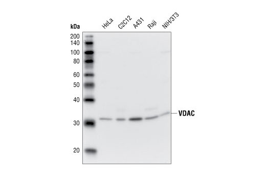 Western Blotting Image 1: VDAC Antibody