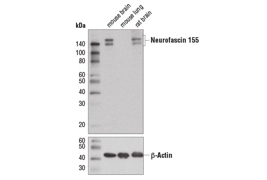 Western Blotting Image 1: Neurofascin 155 (D7B6O) Rabbit mAb (BSA and Azide Free)