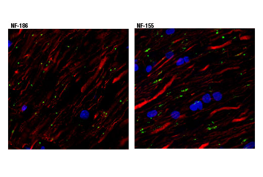 Immunofluorescence Image 2: Neurofascin 155 (D7B6O) Rabbit mAb (BSA and Azide Free)