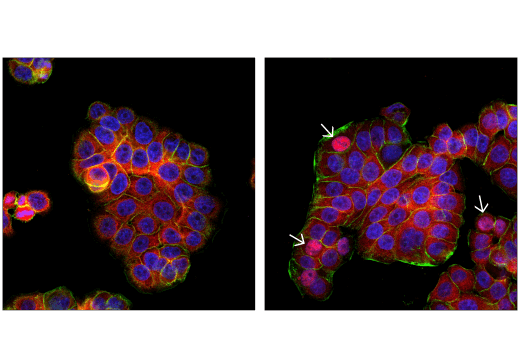 Immunofluorescence Image 1: IRF-3 (D9J5Q) Mouse mAb (Alexa Fluor® 647 Conjugate)
