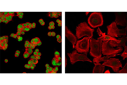 Immunofluorescence Image 1: GATA-6 (D61E4) XP® Rabbit mAb (BSA and Azide Free)