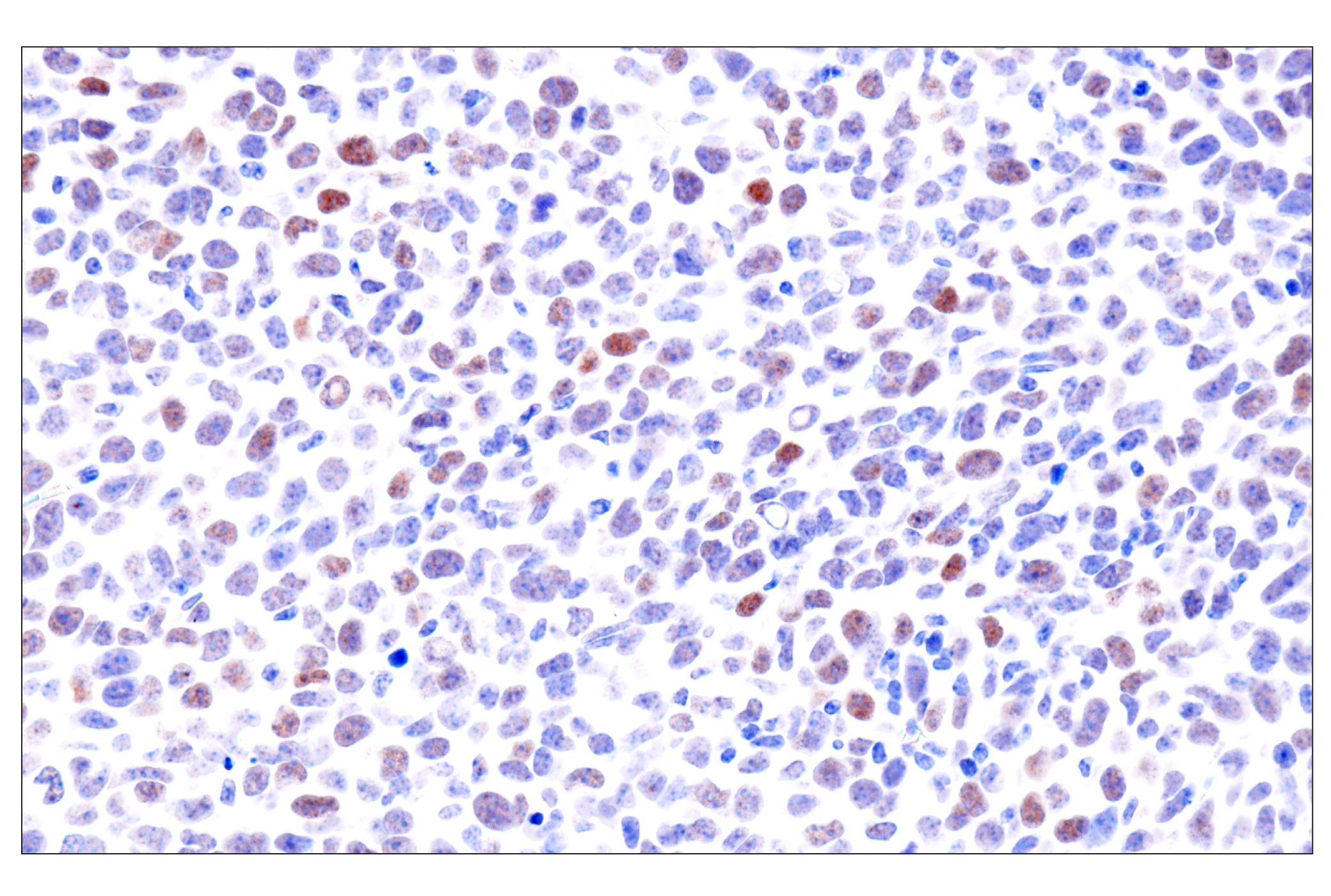 Immunohistochemistry Image 16: GATA-6 (D61E4) XP® Rabbit mAb (BSA and Azide Free)