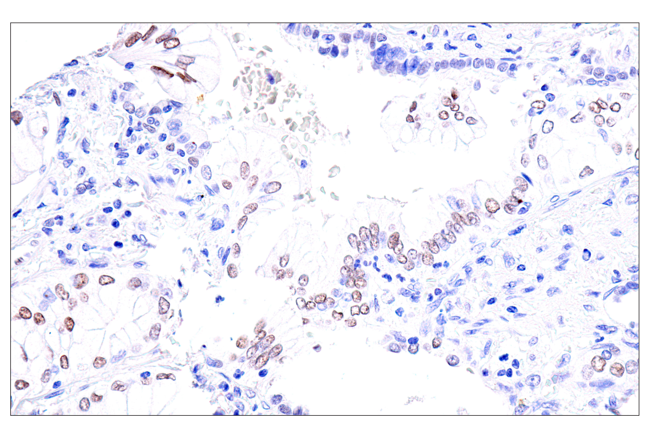 Immunohistochemistry Image 6: GATA-6 (D61E4) XP® Rabbit mAb (BSA and Azide Free)