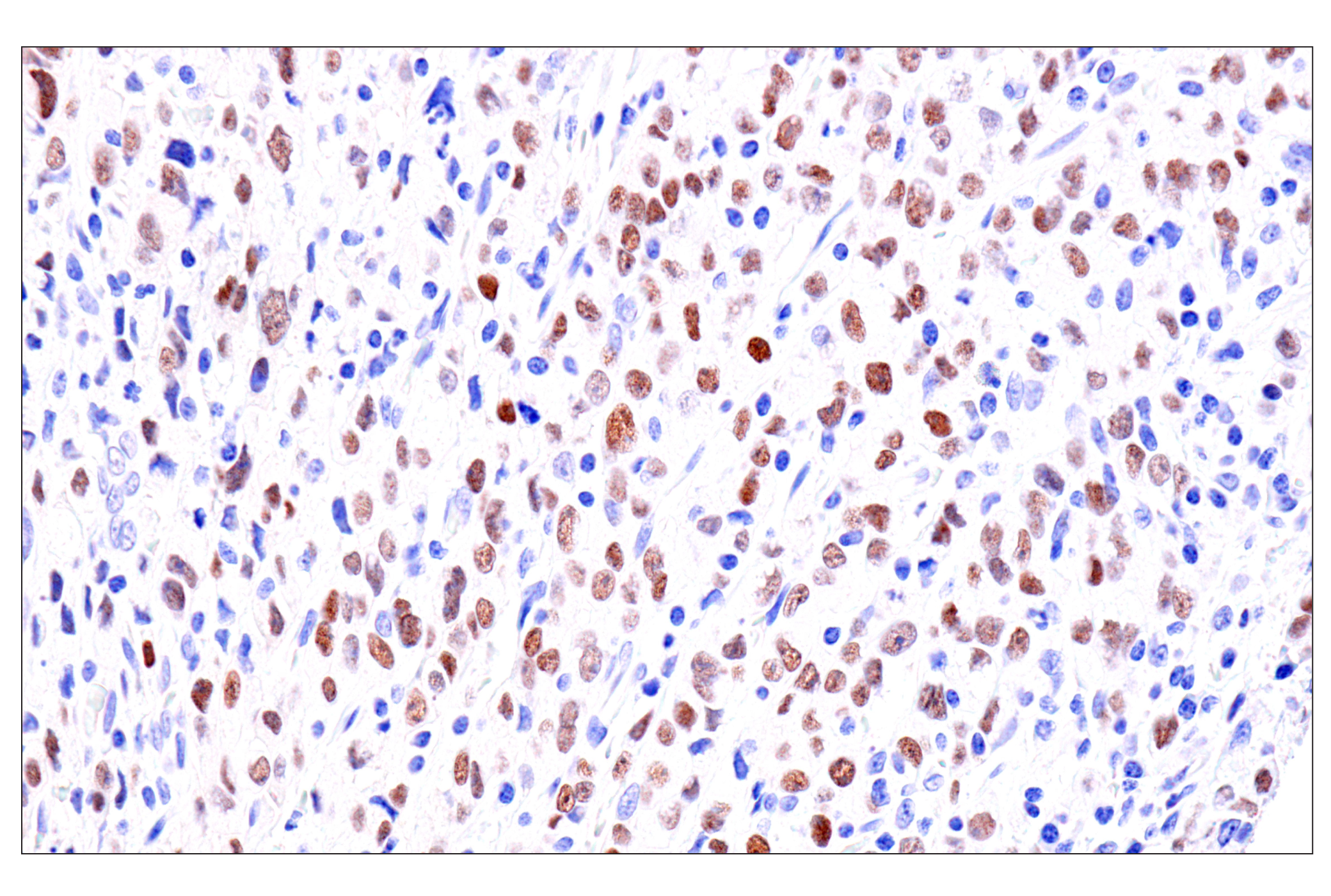 Immunohistochemistry Image 3: GATA-6 (D61E4) XP® Rabbit mAb (BSA and Azide Free)