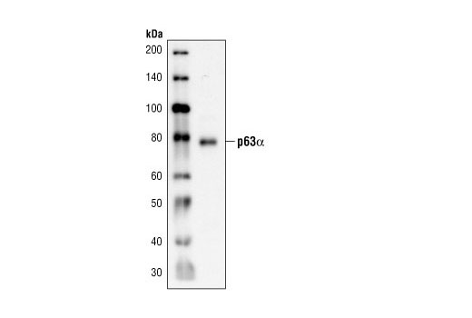 Western Blotting Image 1: p63-α Antibody