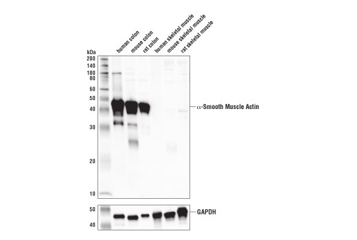 Western Blotting Image 1: α-Smooth Muscle Actin (1A4) Mouse mAb (IF Formulated)