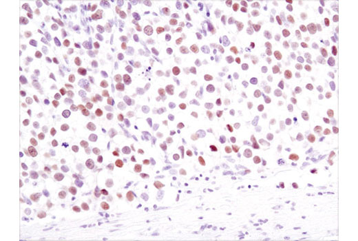 Immunohistochemistry Image 1: Nanog (1E6C4) Mouse mAb