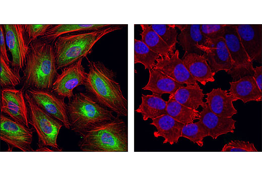 Immunofluorescence Image 1: Keratin 7 (R458) Antibody