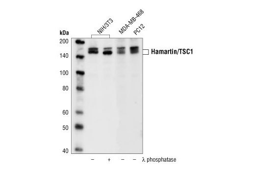 Western Blotting Image 1: Hamartin/TSC1 Antibody