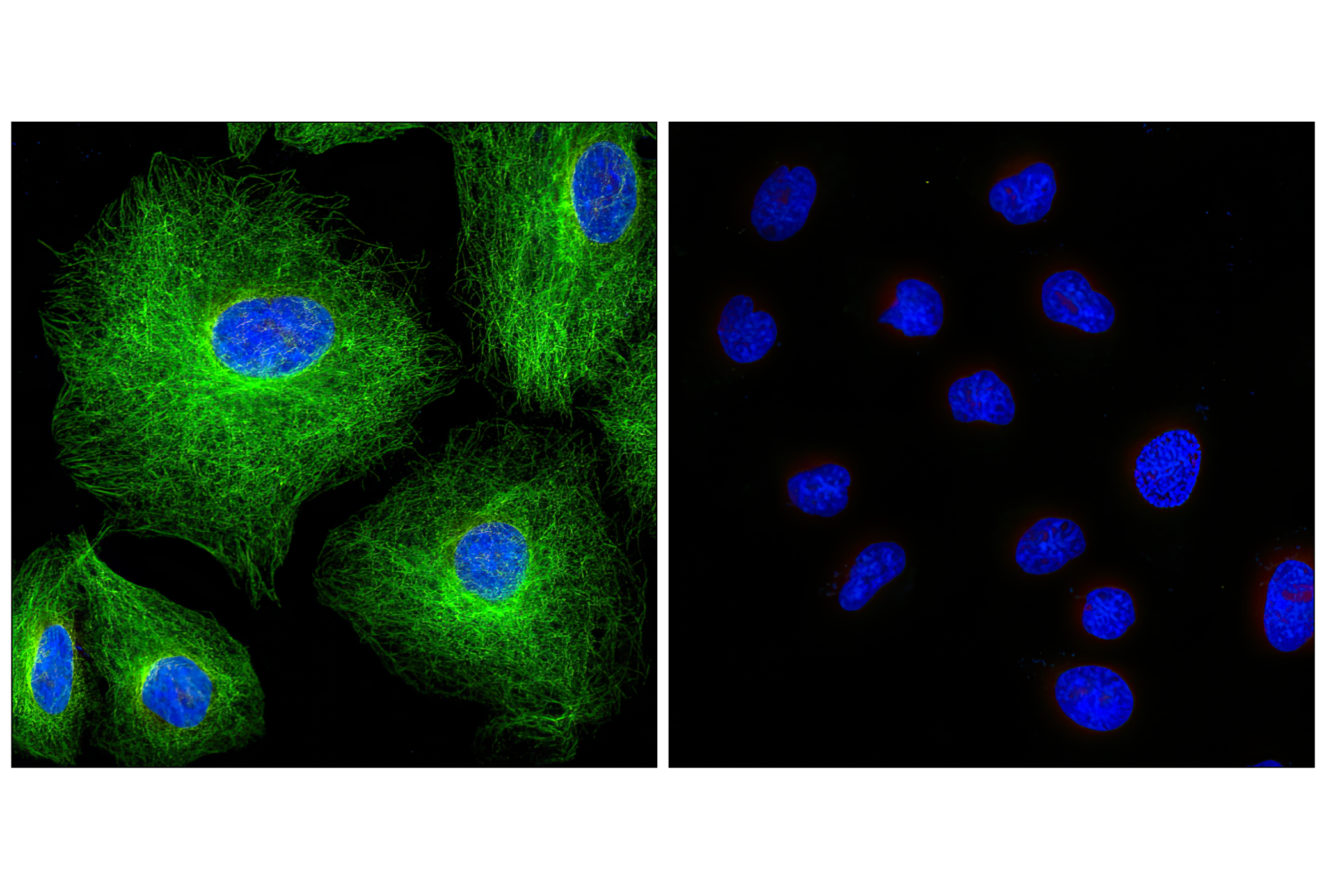 Immunofluorescence Image 1: Rabbit (DA1E) mAb IgG XP® Isotype Control (BSA and Azide Free)