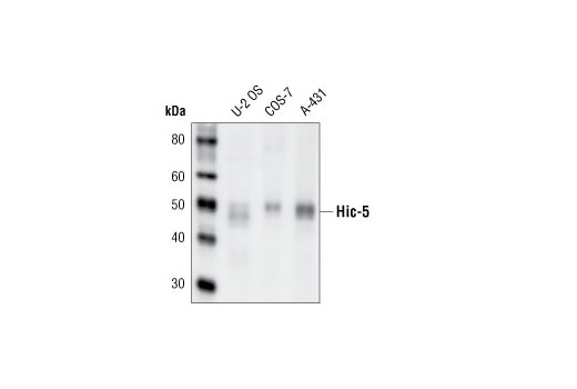 Western Blotting Image 1: Hic-5 Antibody