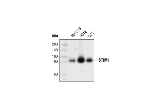 Western Blotting Image 1: STIM1 Antibody
