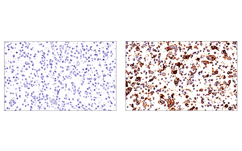 Immunohistochemistry Image 5: PD-L2 (D6L5A) Rabbit mAb (BSA and Azide Free)