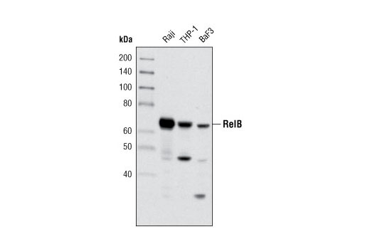  Image 11: NF-κB Family Member Antibody Sampler Kit