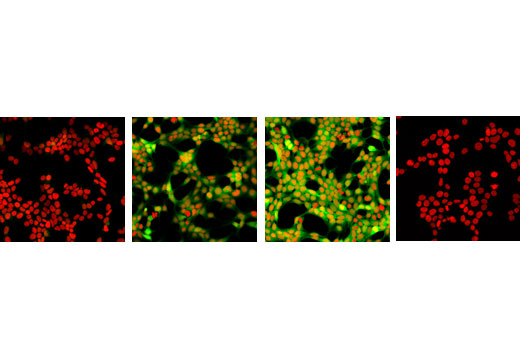 Immunofluorescence Image 1: Non-phospho-4E-BP1 (Thr46) (87D12) Rabbit mAb
