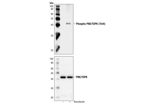 Western Blotting Image 1: Phospho-PBK/TOPK (Thr9) Antibody