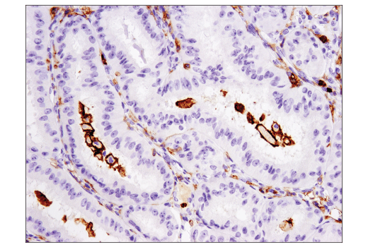 Immunohistochemistry Image 1: CD11b/ITGAM (D6X1N) Rabbit mAb