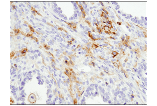 Immunohistochemistry Image 2: CD11b/ITGAM (D6X1N) Rabbit mAb
