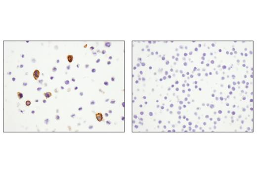 Immunohistochemistry Image 5: CD11b/ITGAM (D6X1N) Rabbit mAb