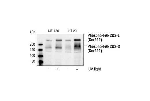 Western Blotting Image 1: Phospho-FANCD2 (Ser222) Antibody