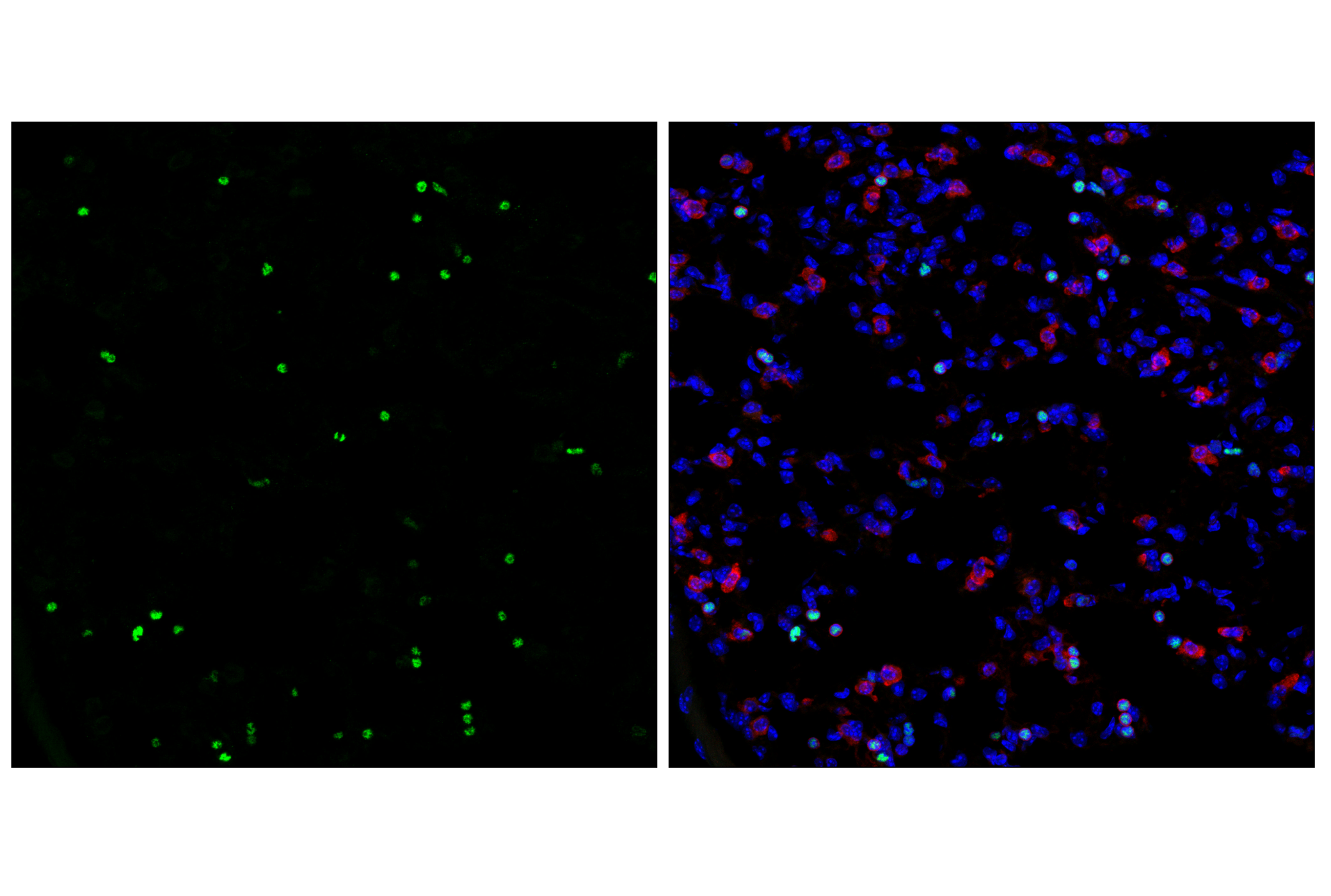 Immunofluorescence Image 1: POU2F2 (F3B7M) Rabbit mAb